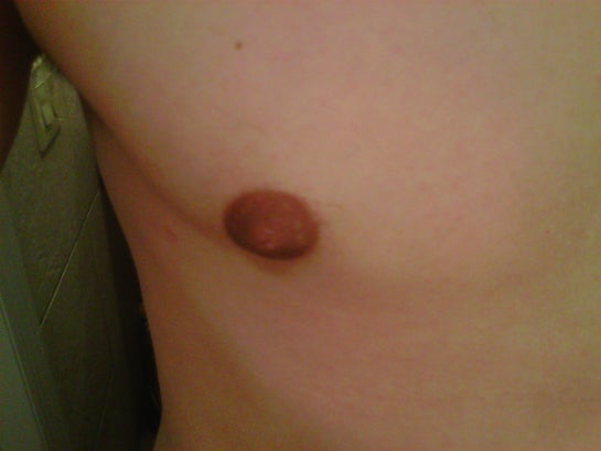 charles gagne add photo tiny puffy nipples