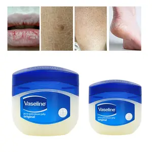 brian ngure recommends anal lube vaseline pic