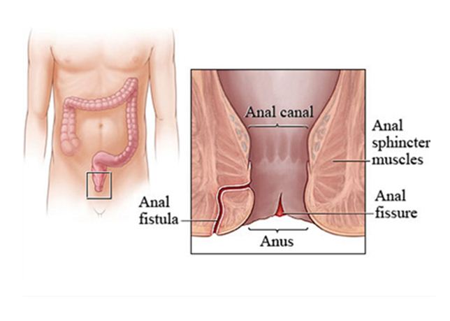 alex bardis recommends Anal In Dubai