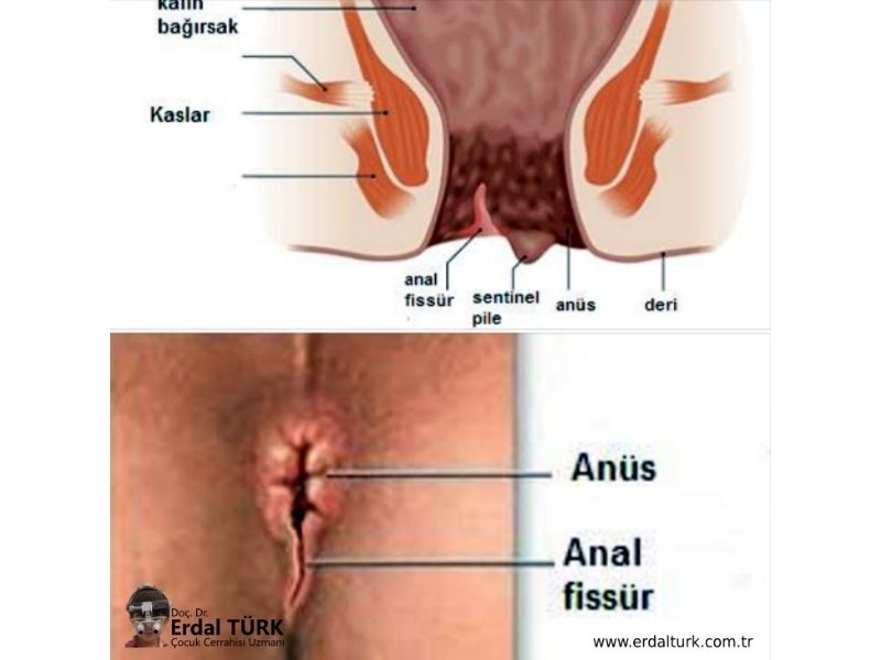 brandon alamo add turk anal photo